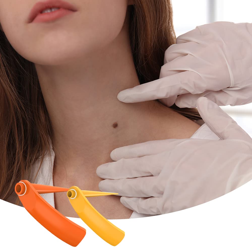 MAYCREATE Skin Tag Removal Tool 2 in 1 Skin Tag Remover Painless Skin Mole Tag Remover Set Safe and Easy to Remove 2mm-7mm Skin Tags MAYCREATE Skin Tag Removal Tool 2 in 1 Skin Tag Remover Painless Skin Mole Tag Remover Set Safe and Easy to Remove 2mm-7mm Skin Tags